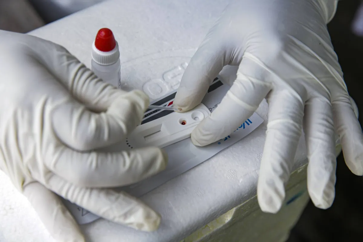 Teste sorológico e rápido medem presença de anticorpos no sangue