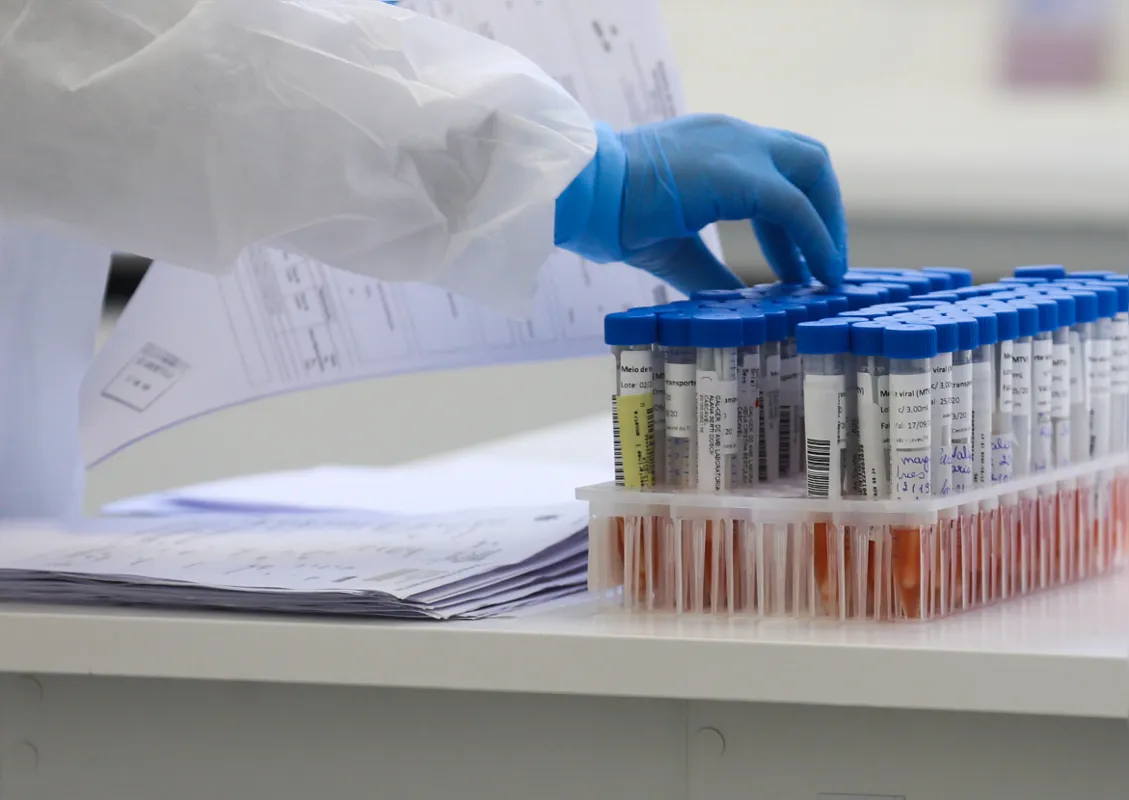 A Secretaria de Estado da Saúde divulgou neste sábado (6) 3.421 novos casos confirmados e 60 mortes em decorrência da infecção causada pelo novo coronavírus.  Os dados acumulados do monitoramento mostram que o Paraná soma 564.097 casos confirmados e 10.298 mortos em decorrência da doença.  