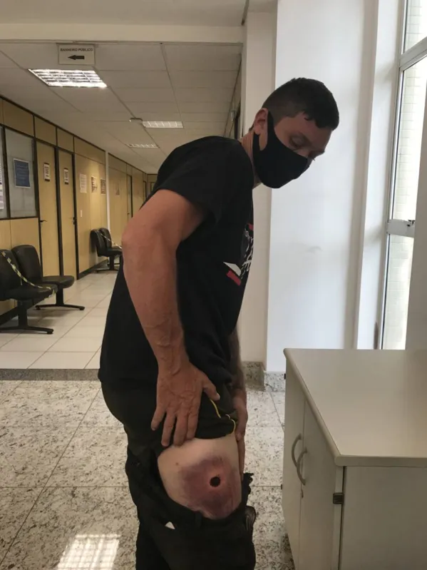 Um dos atingidos com três balas de borracha foi Fernando Alfradique Scanferla