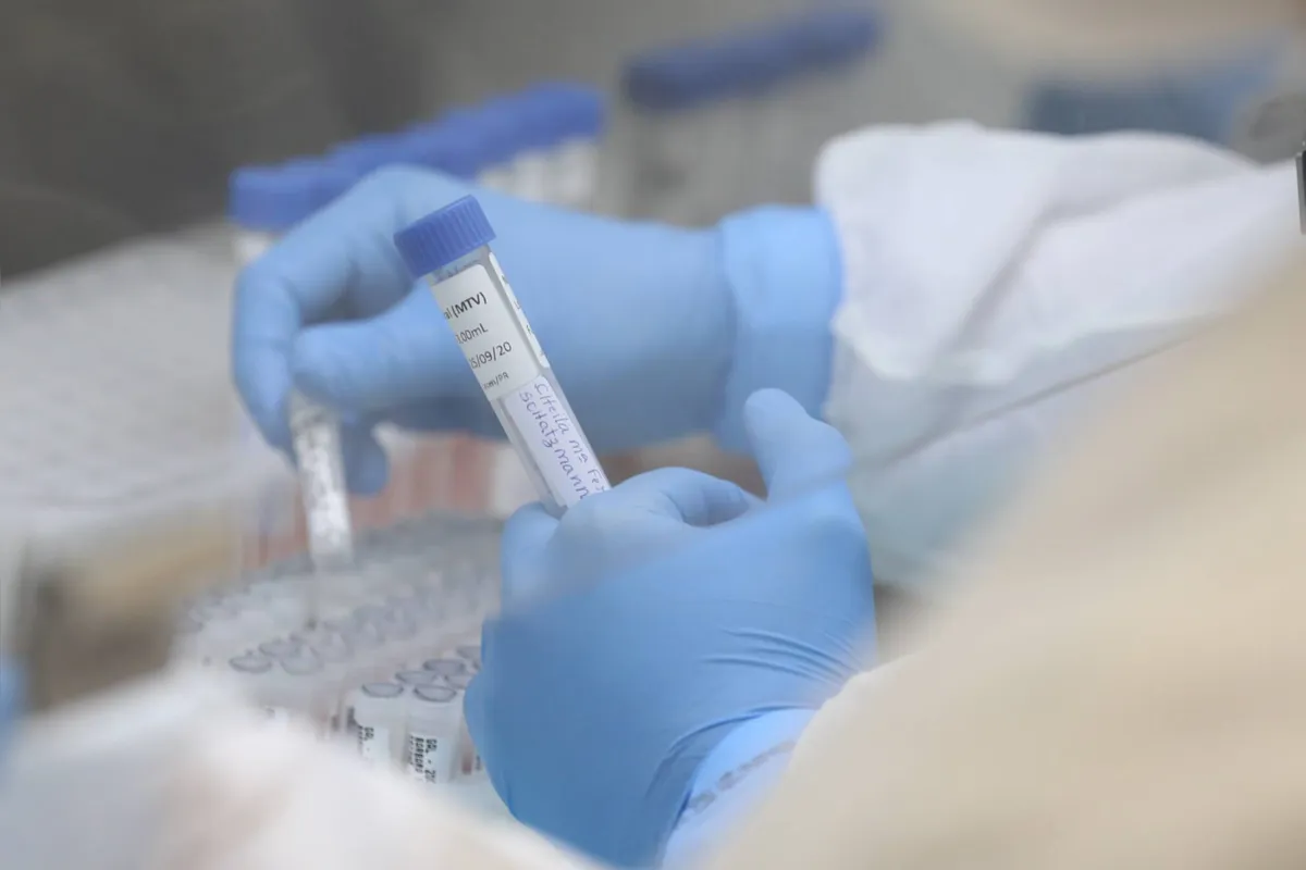 Há 2.818 pacientes com diagnóstico confirmado de Covid-19 estão internados. São 2.203 pacientes em leitos SUS (984 em UTI e 1.219 em leitos clínicos/enfermaria) e 616 em leitos da rede particular (309 em UTI e 307 em leitos clínicos/enfermaria).