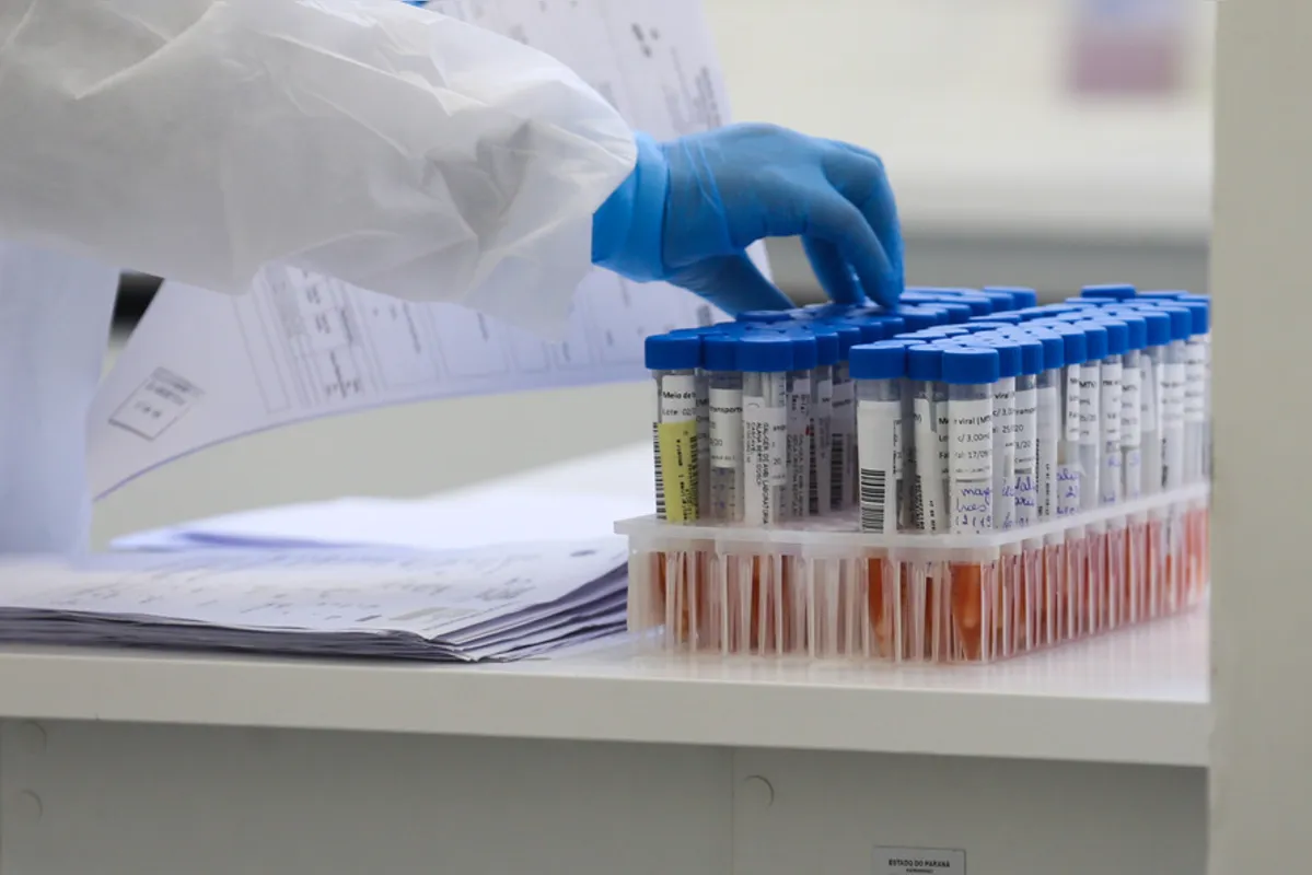 Até agora foram realizados 196.057 testes RT-PCR dos quais 69 aguardam os resultados e 128.595 foram descartados e  67.393 casos confirmados da doença.