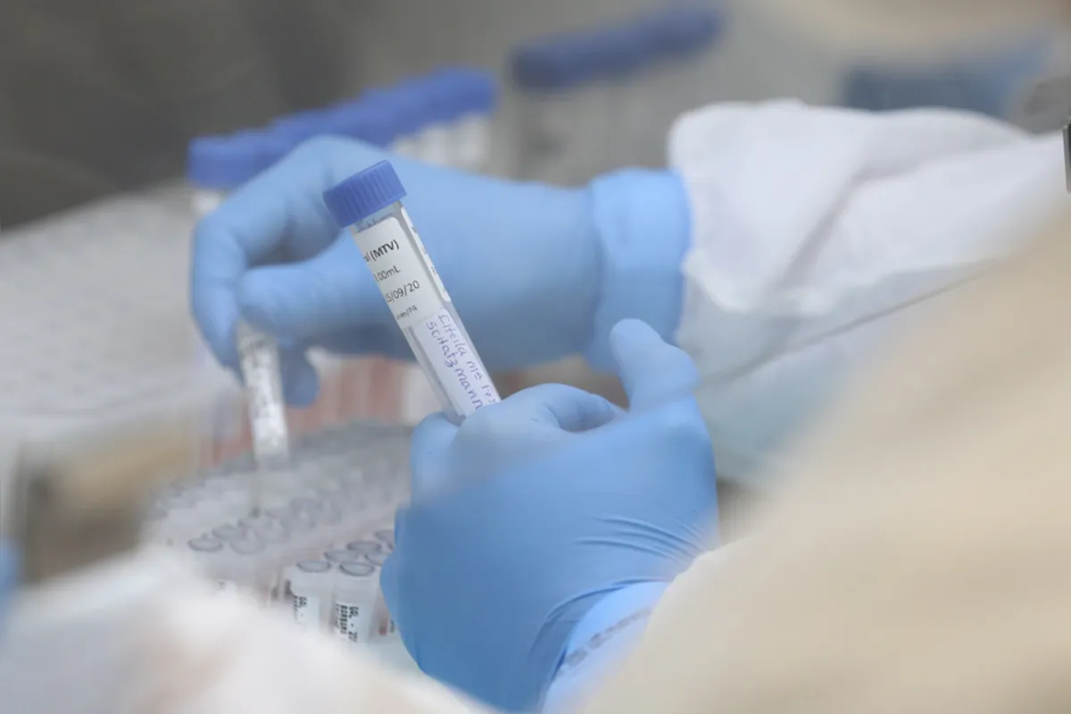 O informe relata que 2.255 pacientes com diagnóstico confirmado de Covid-19 estão internados.