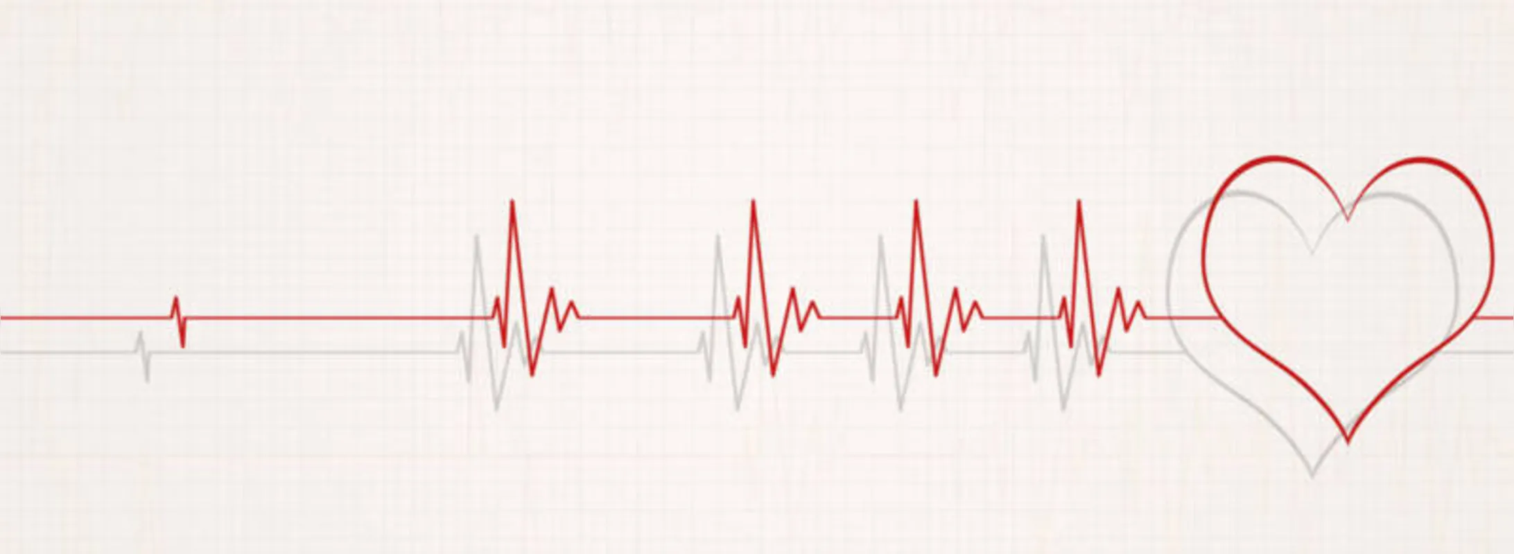 Imagem ilustrativa da imagem Estudo indica que infartos são mais comuns na segunda-feira