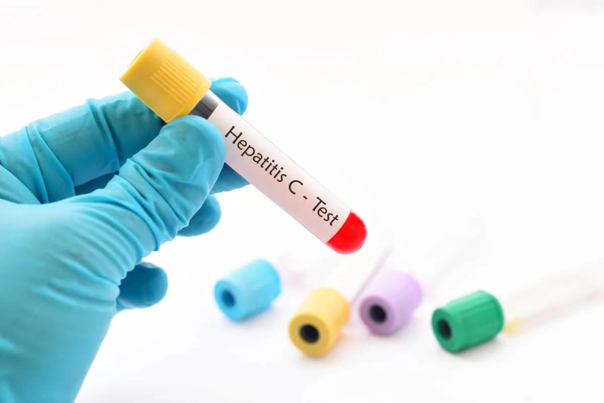 Imagem ilustrativa da imagem Queda no diagnóstico de hepatites pode aumentar 'mortes silenciosas'