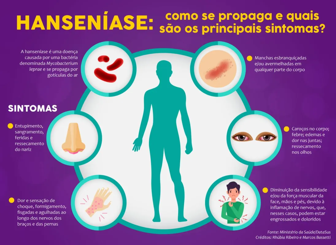 Imagem ilustrativa da imagem UFPR E UFSCar desenvolvem teste para diagnóstico da hanseníase