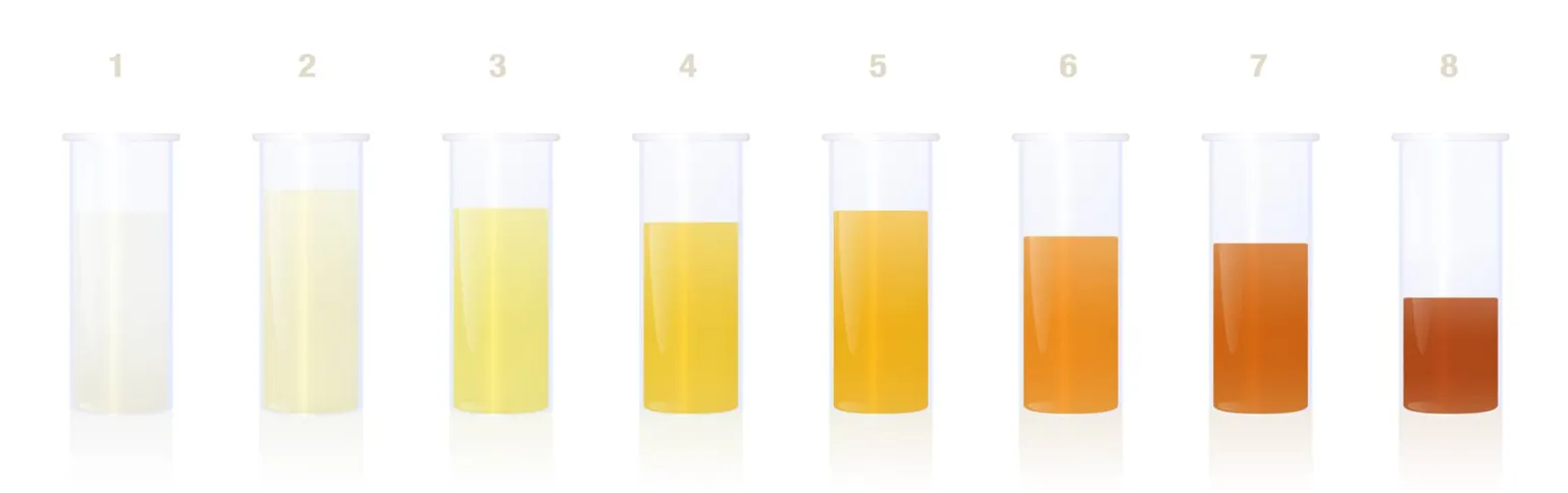 Imagem ilustrativa da imagem A cor da urina pode indicar algum problema de saúde