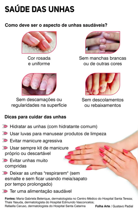 Imagem ilustrativa da imagem Aparência das unhas pode revelar problemas de saúde