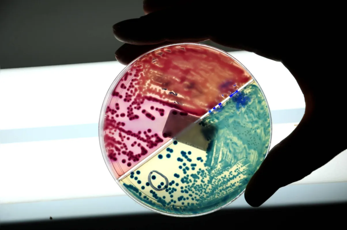 O problema das bactérias resistentes até a antibióticos mais modernos é anterior à pandemia, mas piorou muito durante a crise sanitária