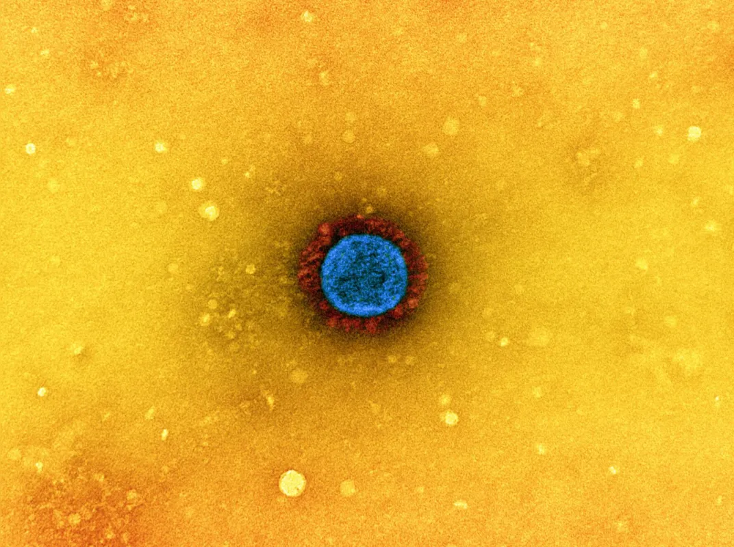 Micrografia eletrônica de transmissão de uma partícula do vírus SARS-CoV-2 , isolada de uma amostra de paciente e cultivada em cultura de células. 
