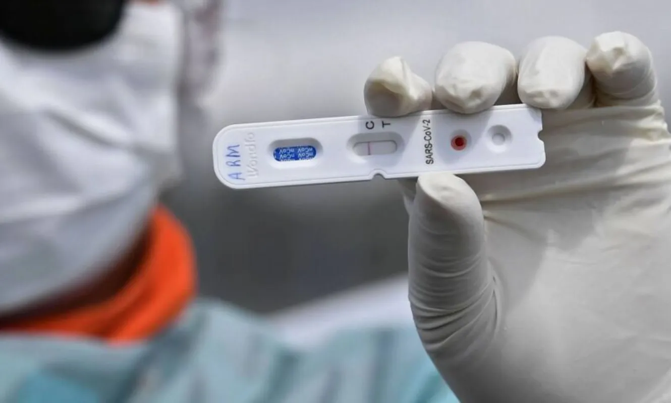 Imagem ilustrativa da imagem Sesa confirma mais 20 mortes e 474 novos casos de Covid-19