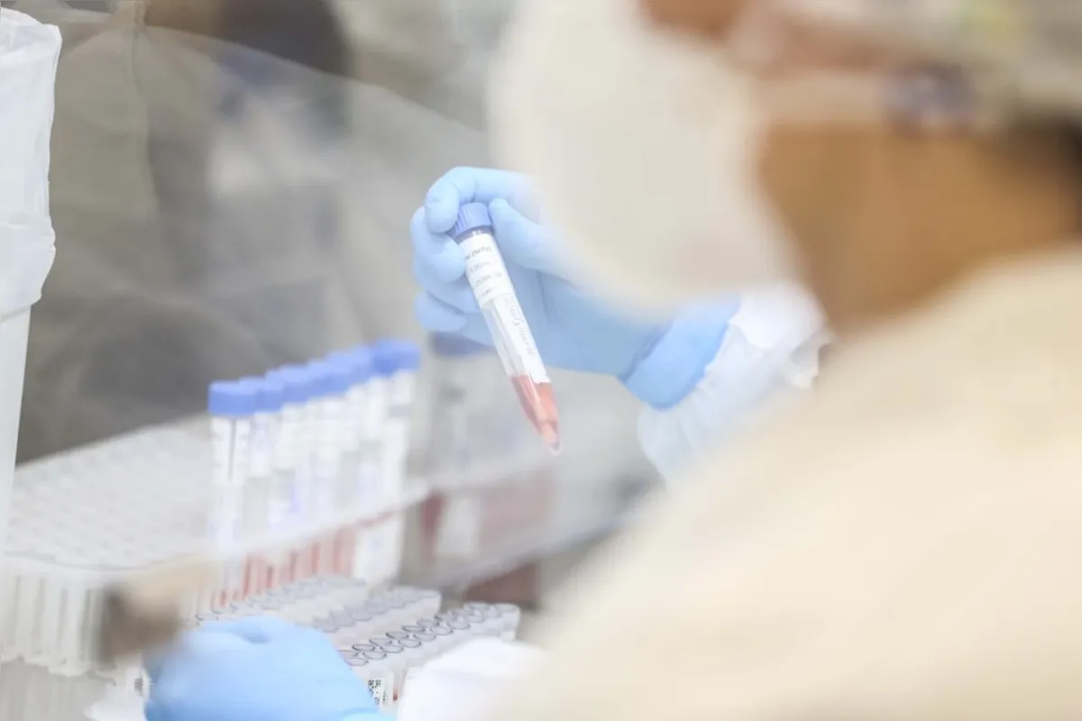 A Sesa (Secretaria de Estado da Saúde) confirmou 224 novos casos de Influenza H3N2 nesta segunda-feira (3) e confirmou que a transmissão é considerada comunitária.  