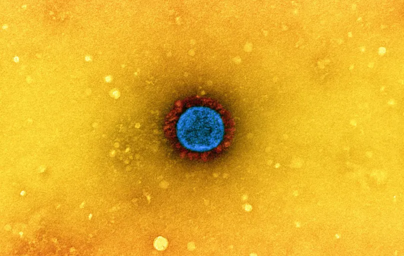 Micrografia eletrônica de transmissão de uma partícula do vírus SARS-CoV-2 , isolada de uma amostra de paciente e cultivada em cultura de células. 