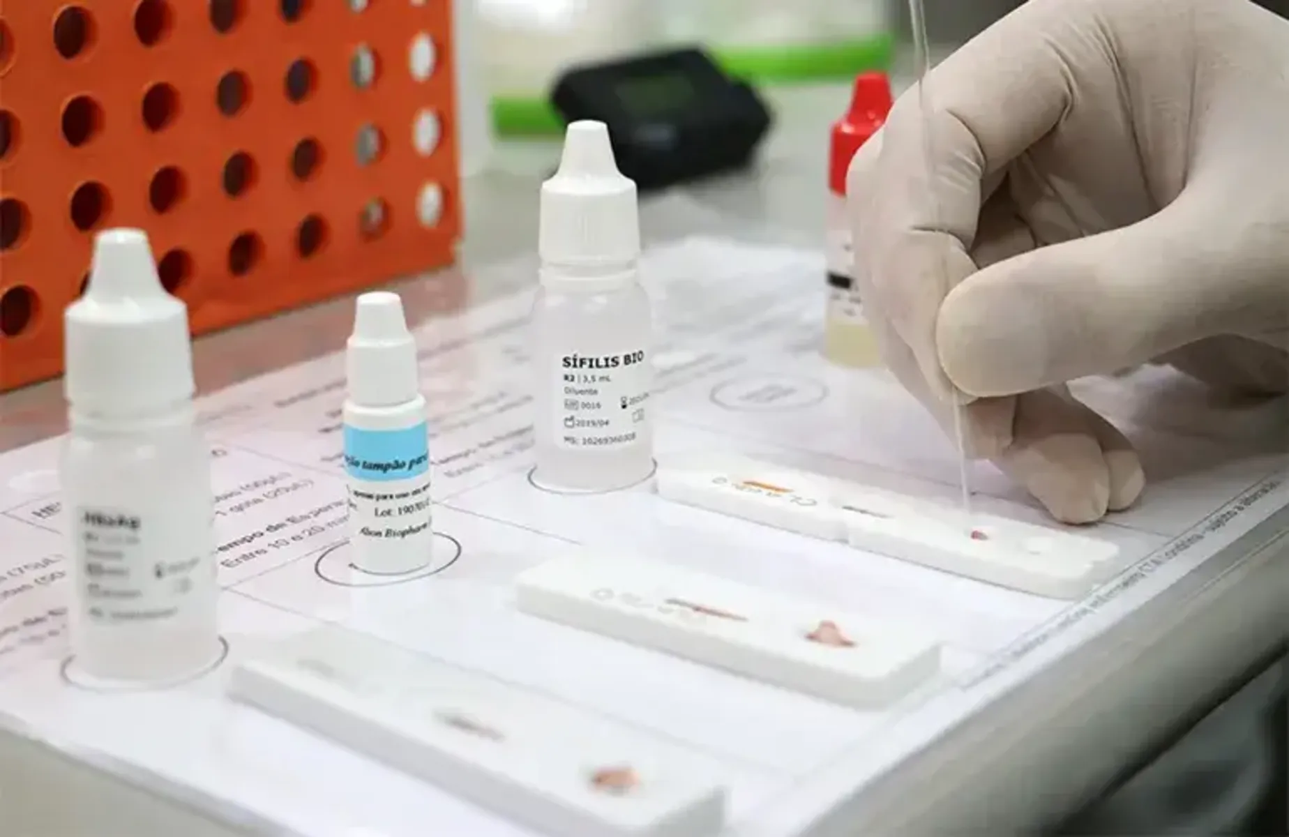 Imagem ilustrativa da imagem Londrina amplia testes rápidos para HIV, sífilis e hepatites B e C em gestantes