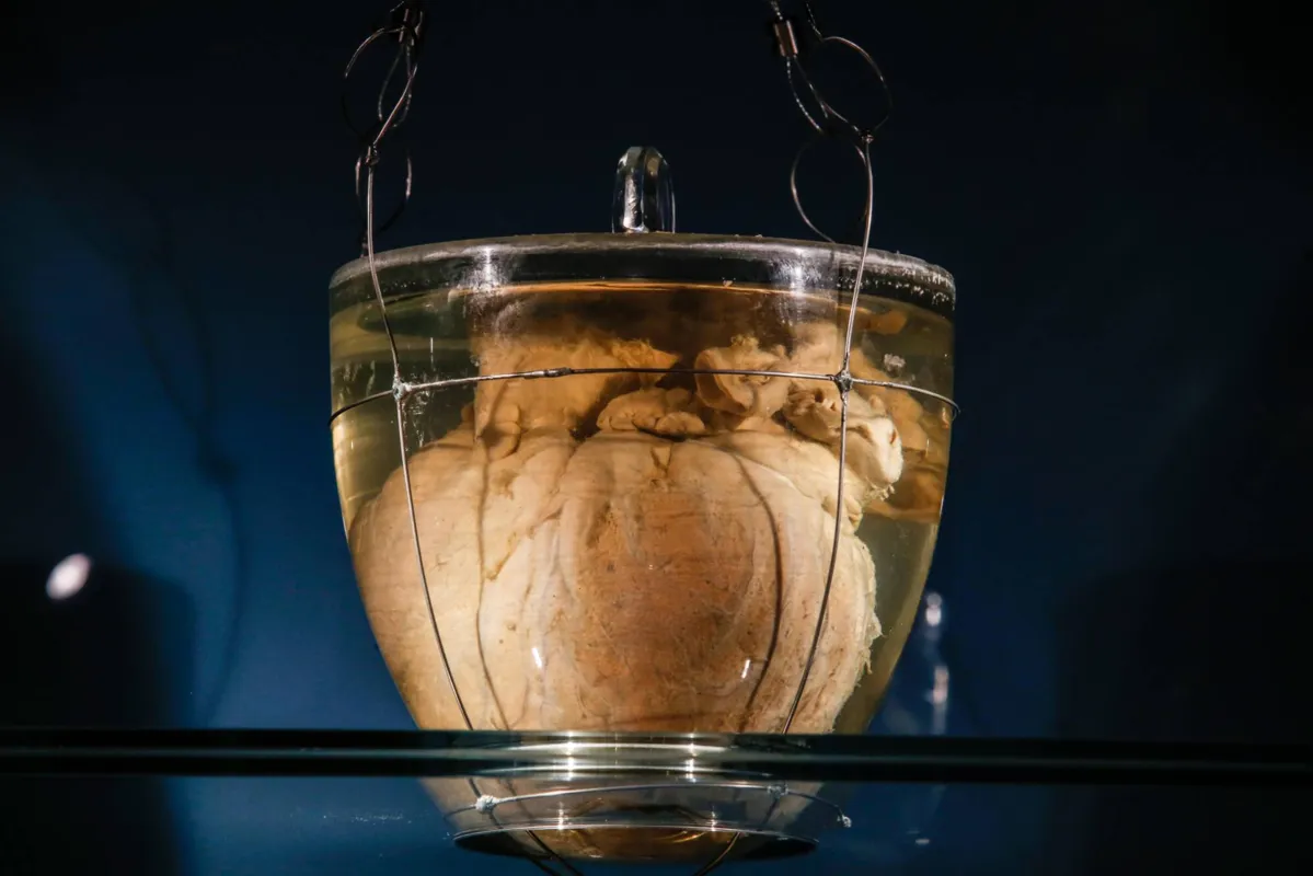 Gabriela Biló/Folhapress 

Dom Pedro 1º morreu de tuberculose em setembro de 1834: mais de duas décadas antes da descoberta do formol