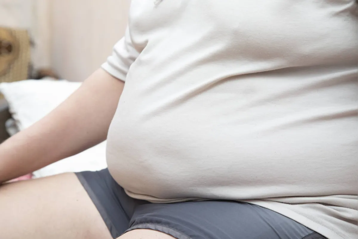 Imagem ilustrativa da imagem Estudo aponta que obesidade pode ser fator de risco para Alzheimer
