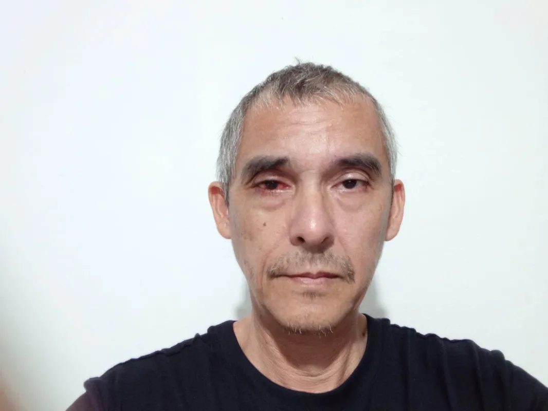 Alexandre Maruishi descobriu a doença em uma visita de rotina: "Quanto mais rápido diagnosticar a doença, mas rápido é o tratamento"