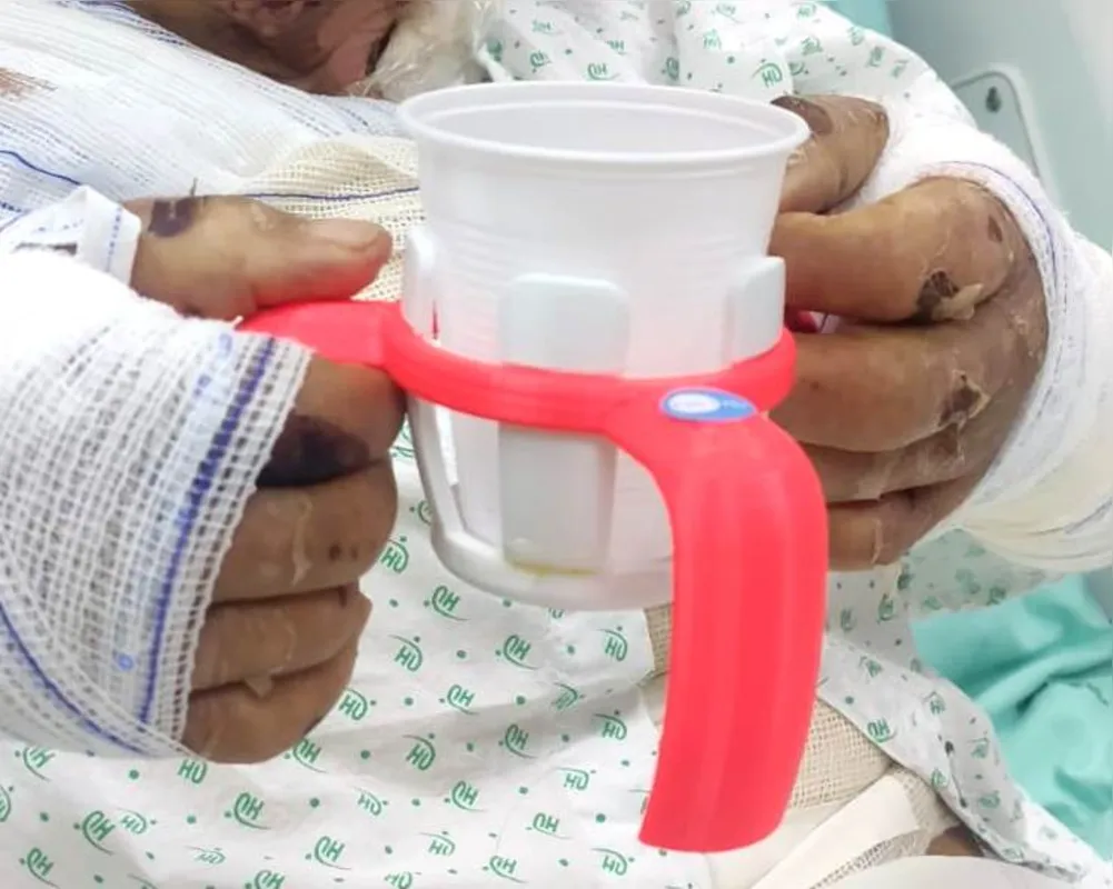 Produzido com tecnologia de impressão 3D, o dispositivo atende pacientes que enfrentam limitações funcionais