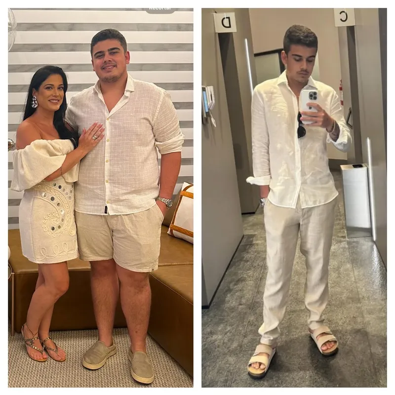 Antes e depois da cirurgia de Cauê Dellalibera