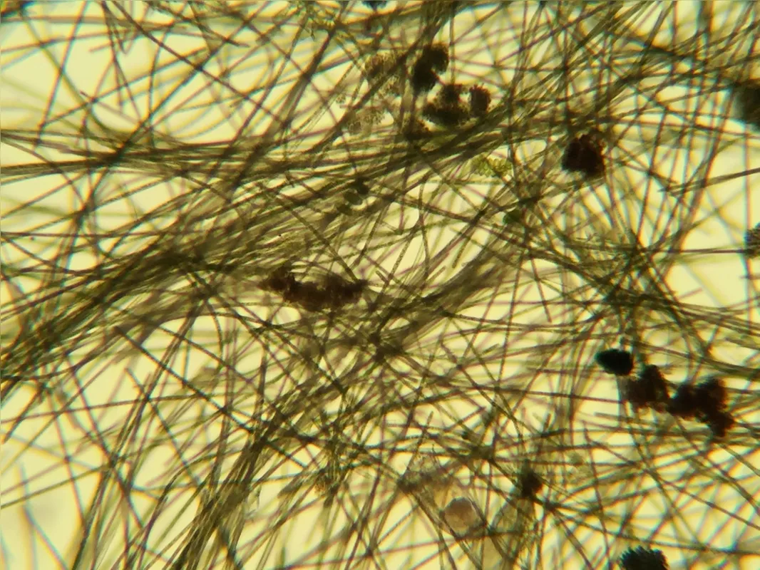 Planktothrix isothrix e espécies do gênero Microcystis