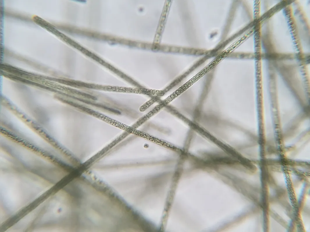 Planktothrix isothrix e espécies do gênero Microcystis