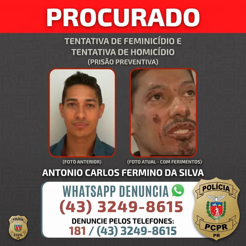 A PC divulgou imagens de Antonio Carlos Fermino da Silva antes e depois das queimaduras
