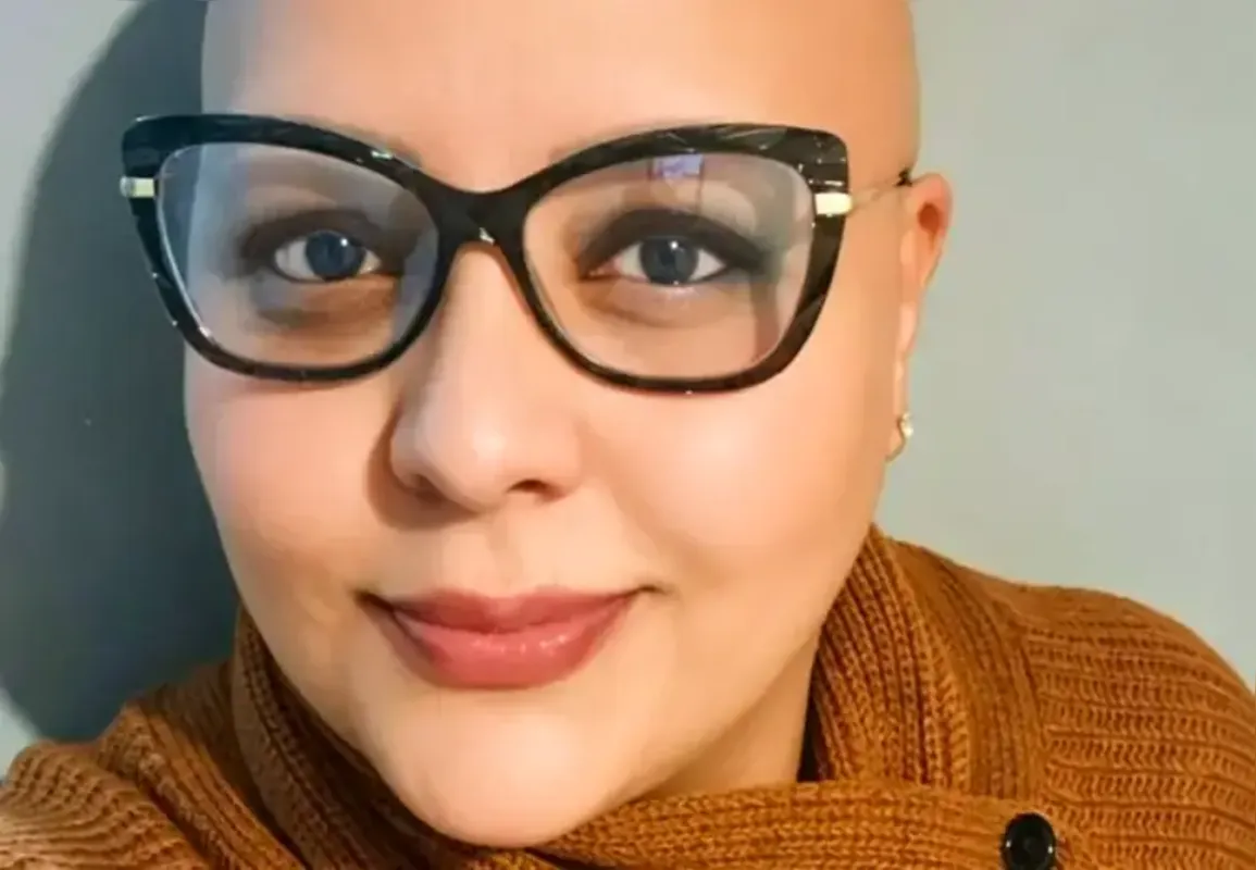 Juliana Fernandes: "Me olho no espelho e me acho normal. Estou mais da metade da minha vida sem cabelo, é natural”