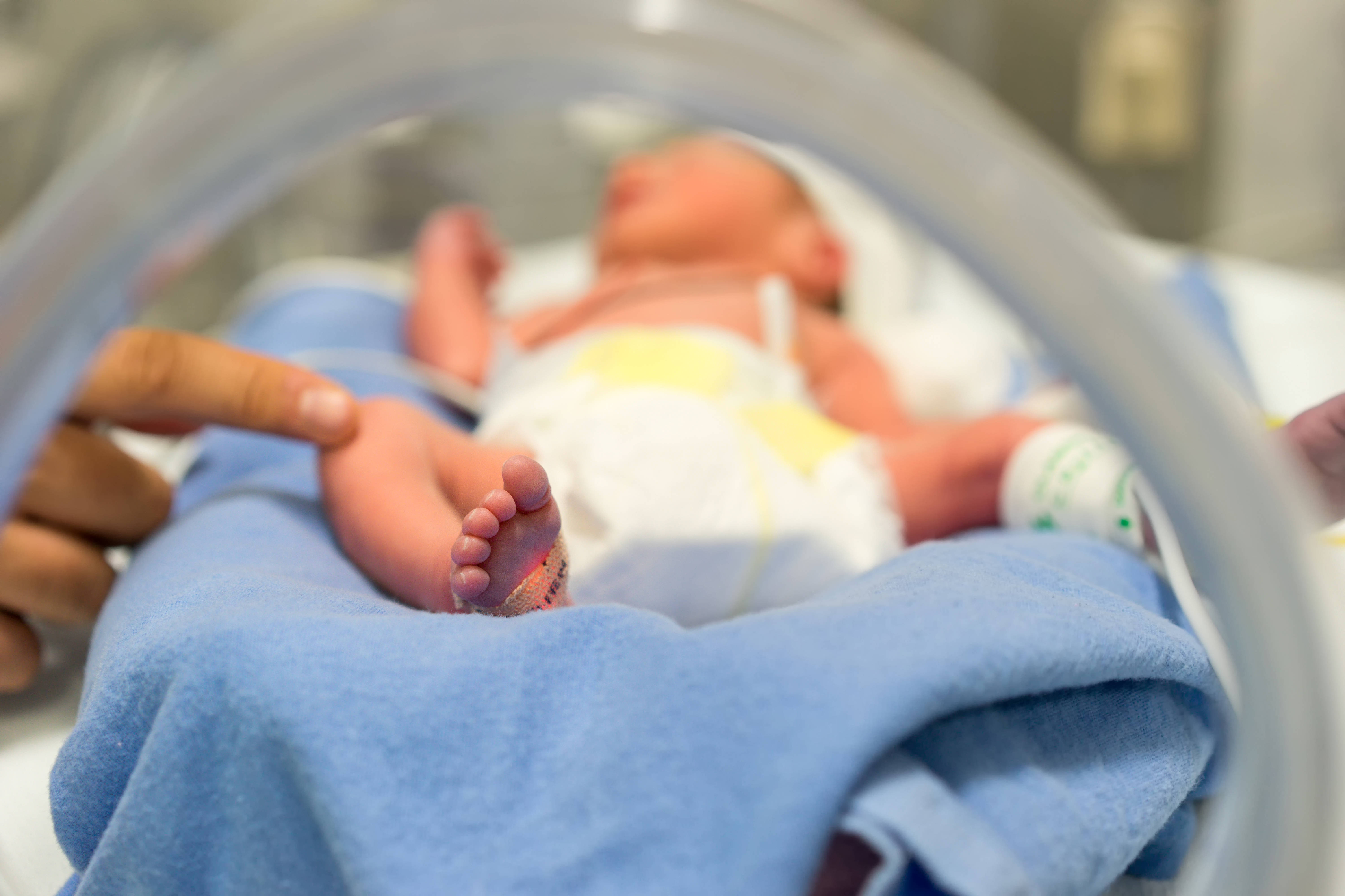Sobrevida De Bebes Extremamente Prematuros