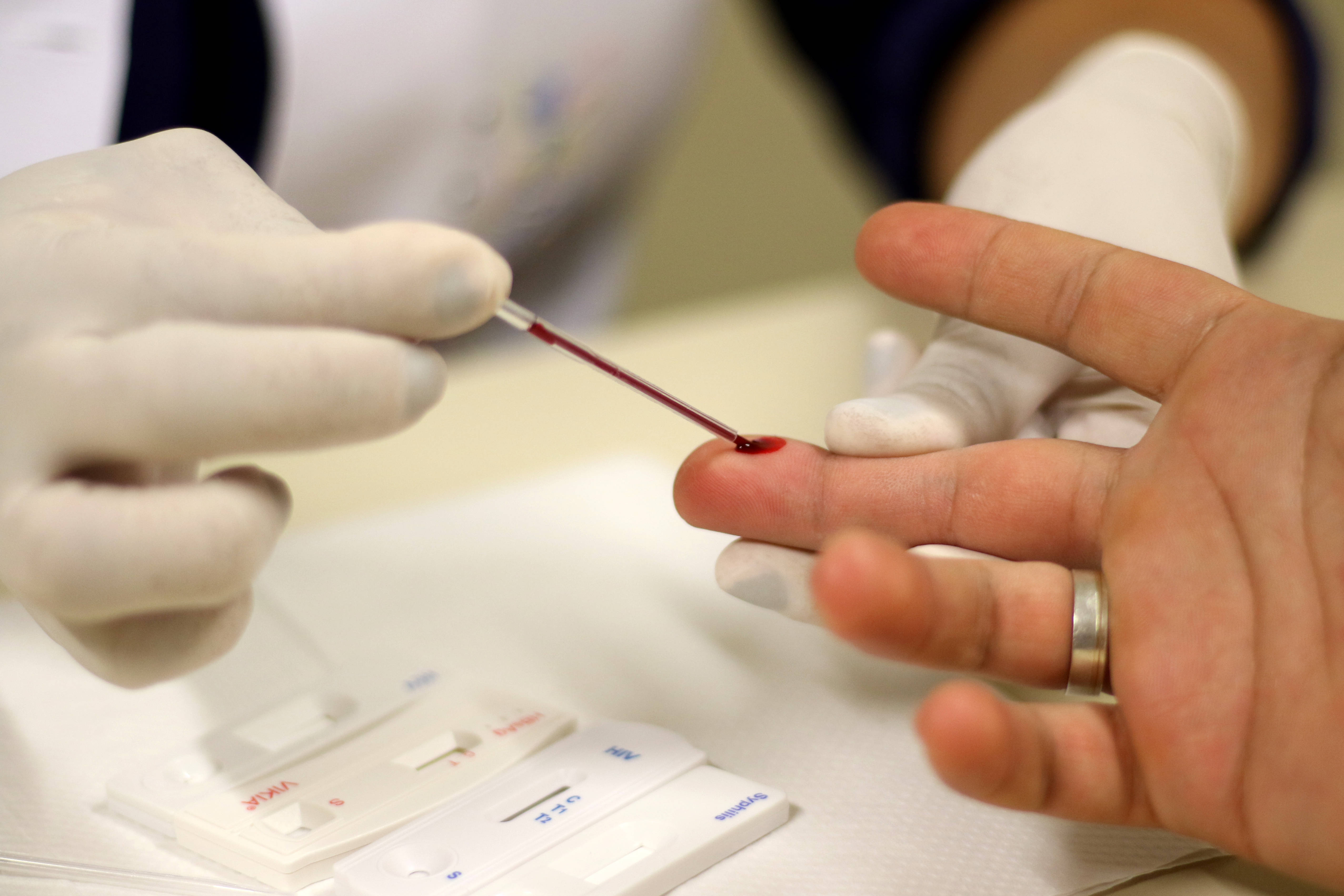 Em 2018, o Ministério da Saúde contabilizou 37 mil novos casos de aids e quase 44 mil de infecção por HIV
