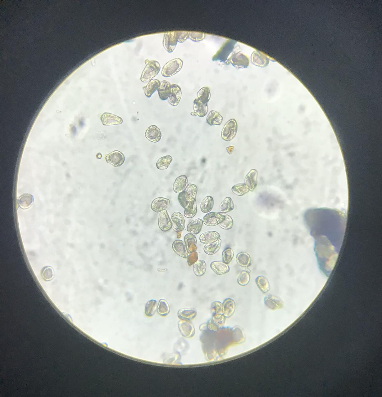 Visão microscópica dos esporos do fungo causador da ferrugem asiática