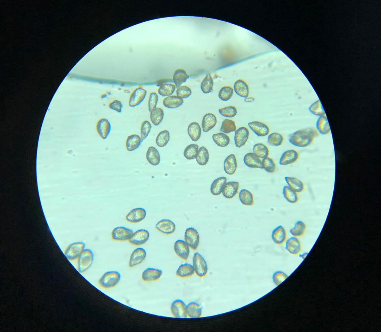 Visão microscópica dos esporos do fungo causador da ferrugem asiática